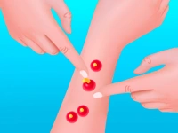 Pimple Poper Rush image